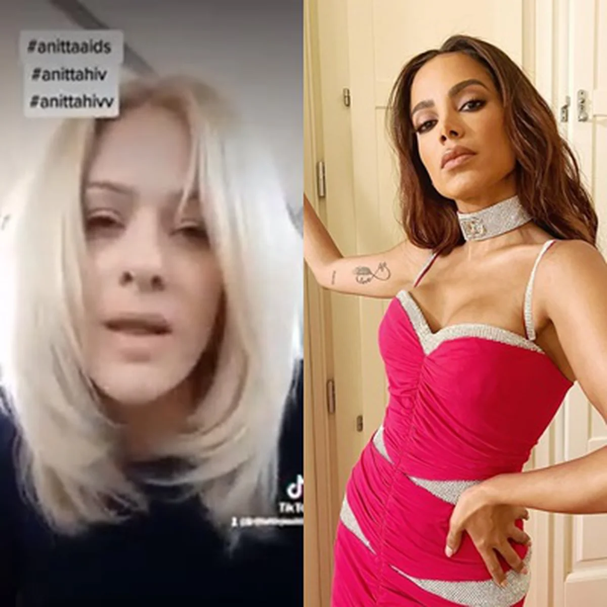 Anitta abre o jogo e comenta sobre cirurgia íntima: foi Deus - Área VIP