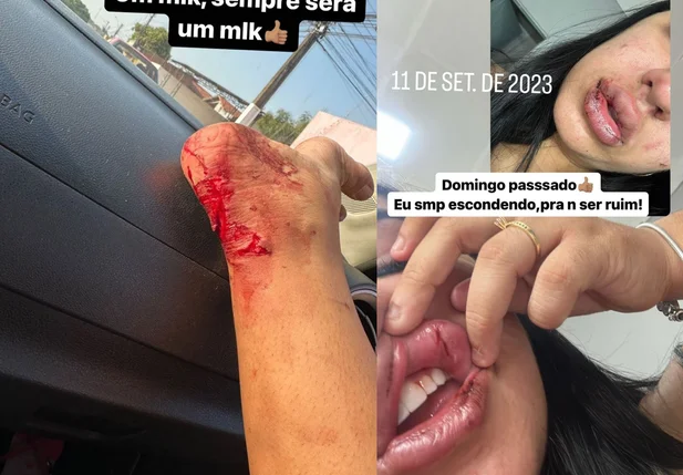 Marcas das agressões