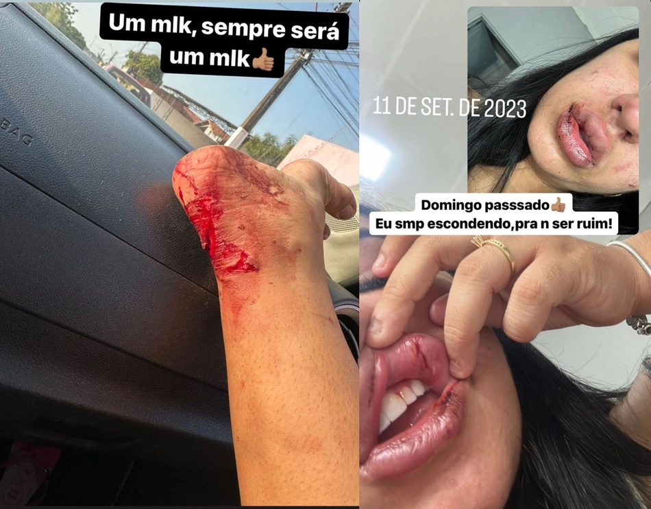 Marcas das agressões