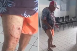 Homem é mordido por jacaré em lagoa no Ceará